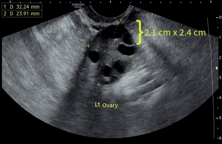 Figure 2