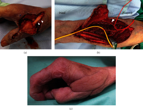 Figure 3