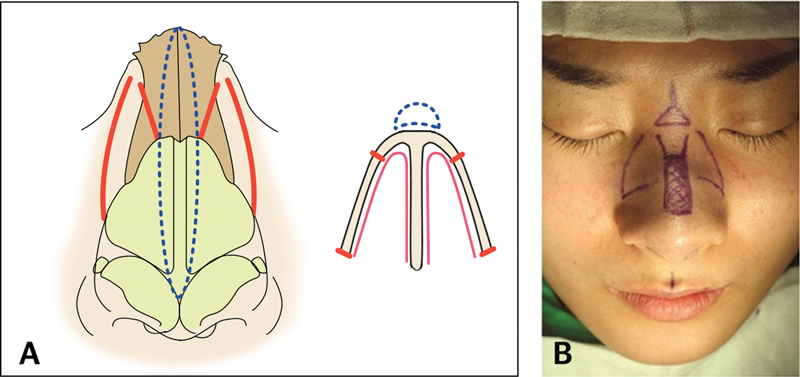 Fig. 12