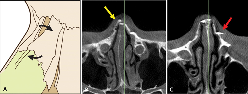 Fig. 14