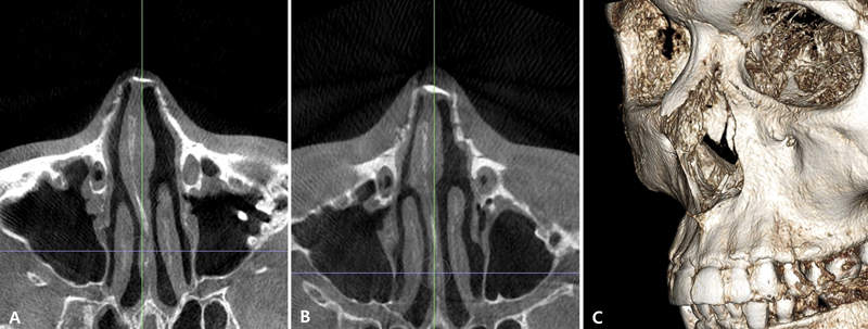 Fig. 15