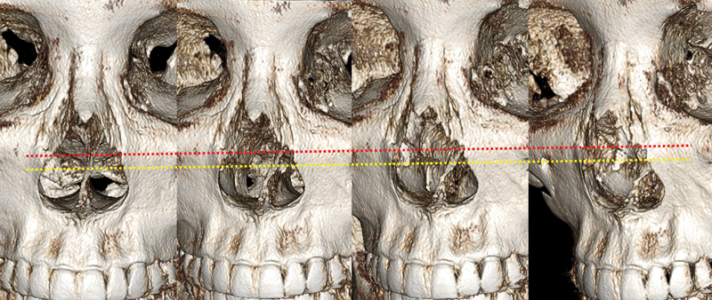 Fig. 7