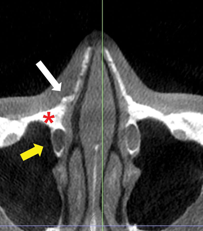 Fig. 8