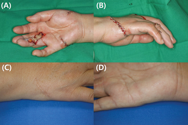 Fig. 6