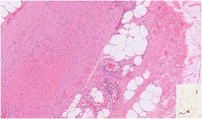 Figure 4