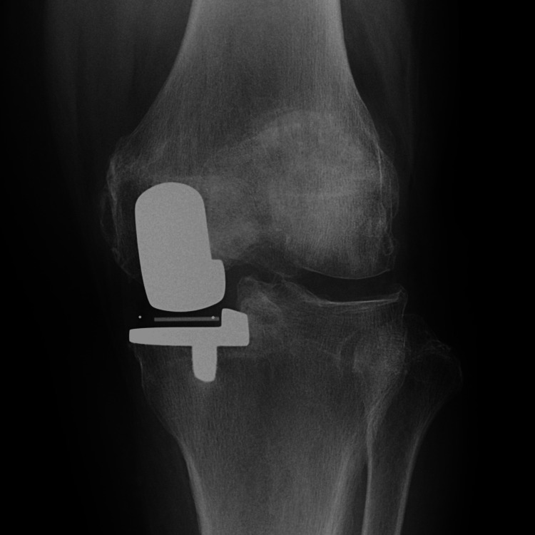 Figure 11