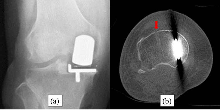 Figure 13