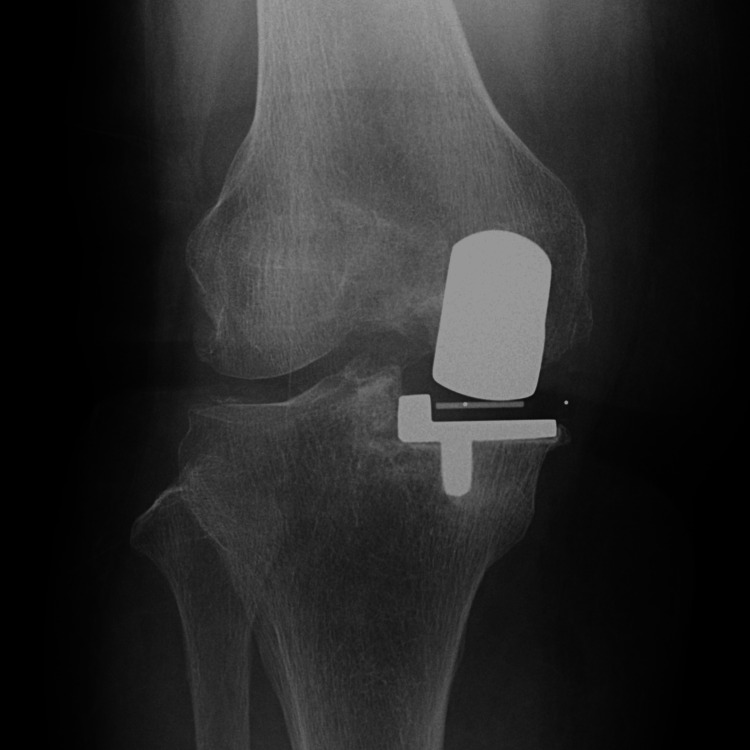 Figure 15