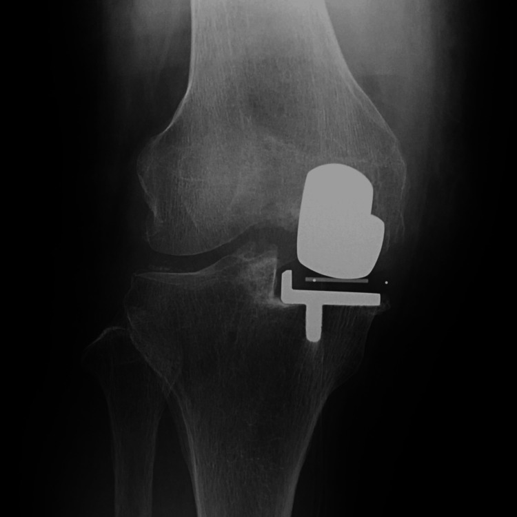 Figure 16
