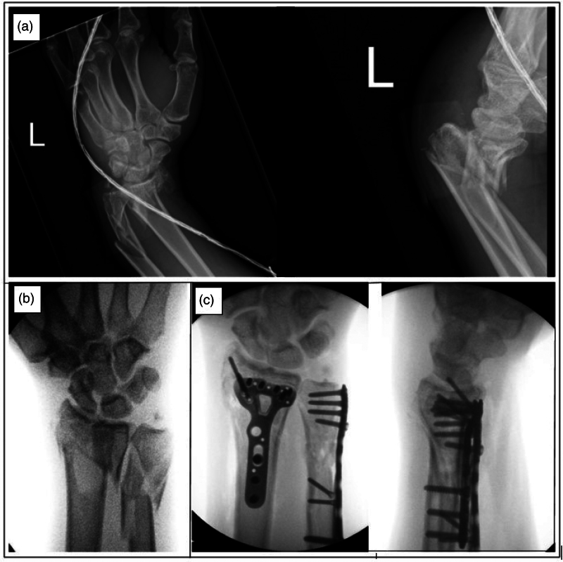 Figure 1