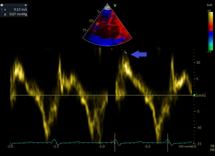 Figure 5