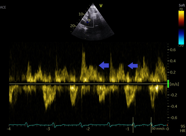 Figure 9