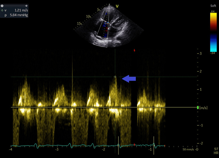 Figure 10