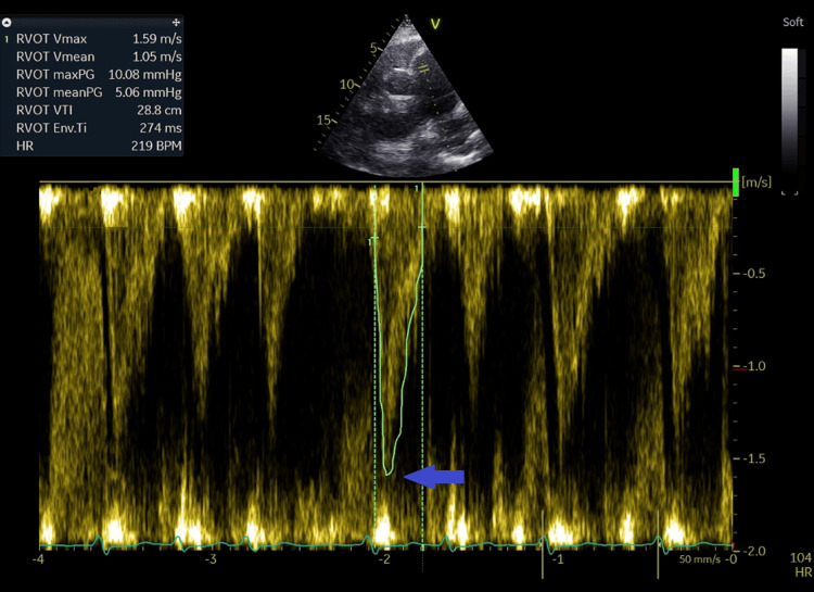 Figure 12