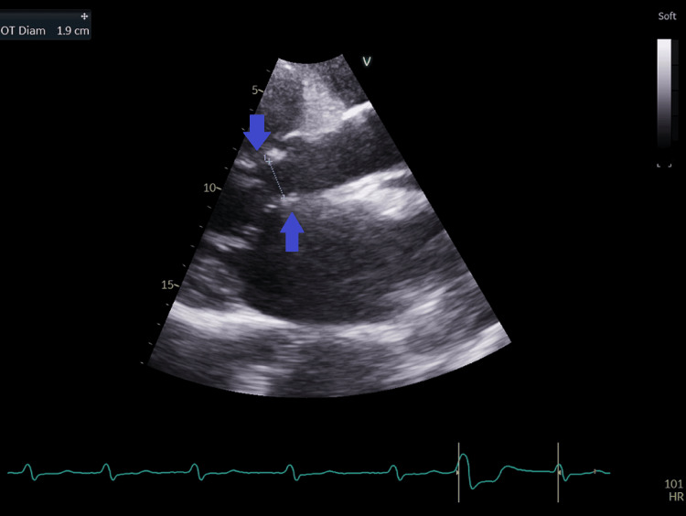 Figure 13