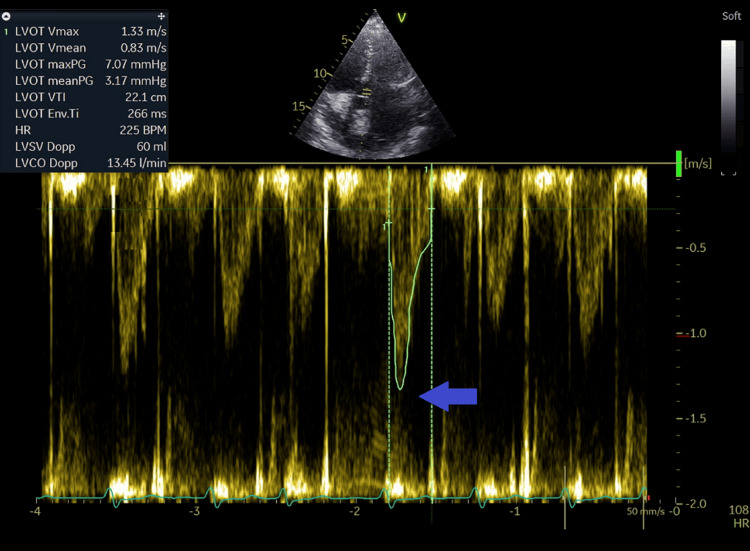 Figure 14