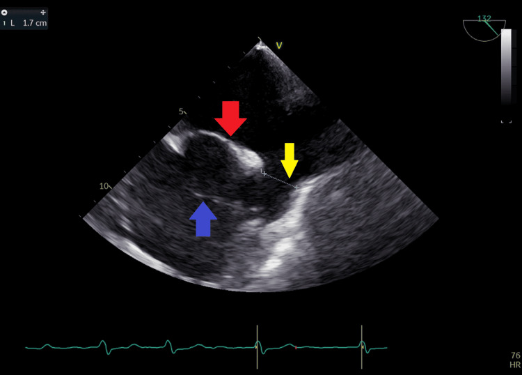 Figure 15
