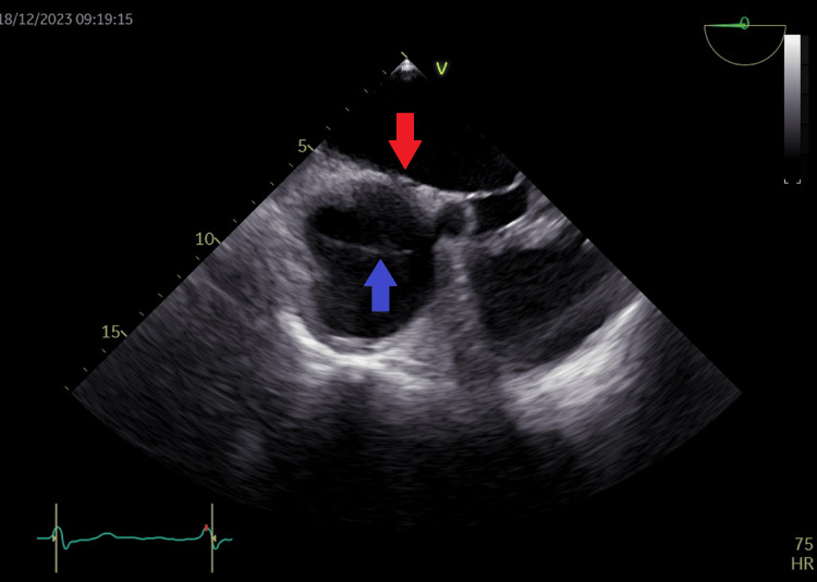Figure 19