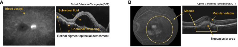 Figure 2