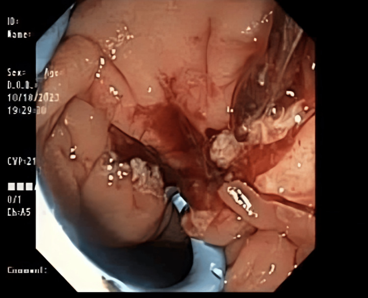 Figure 6