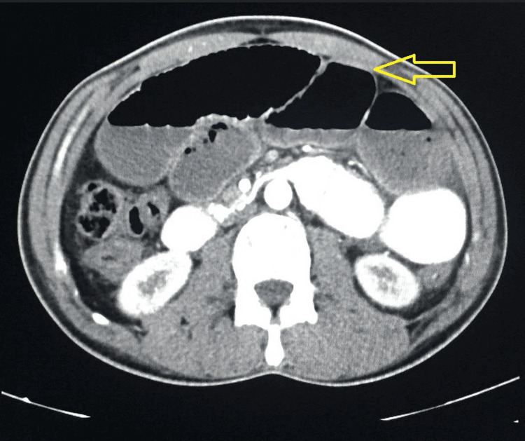 Figure 5