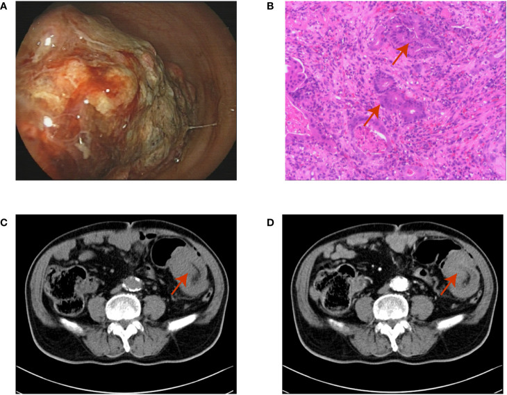 Figure 1
