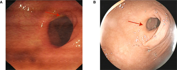Figure 4