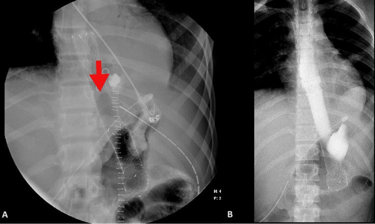 Figure 9