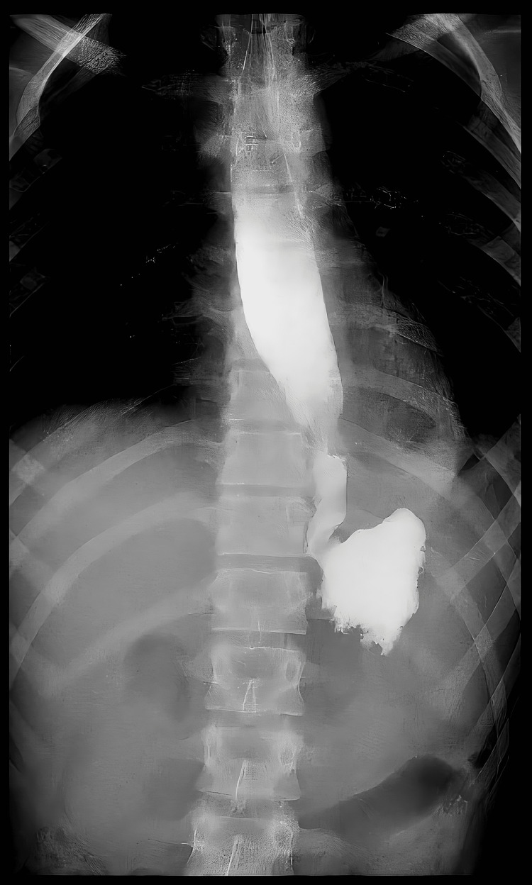 Figure 10