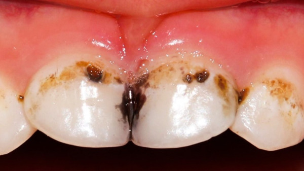 Figure 11