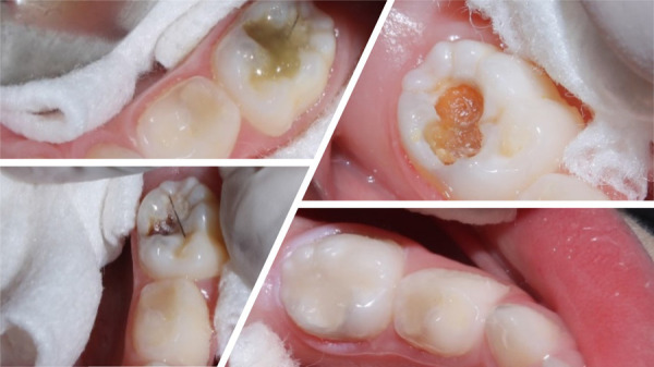 Figure 12