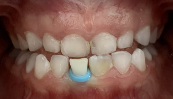 Figure 13