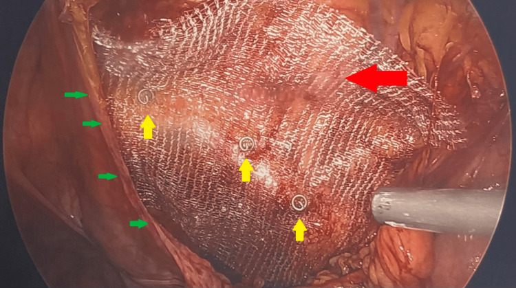 Figure 5