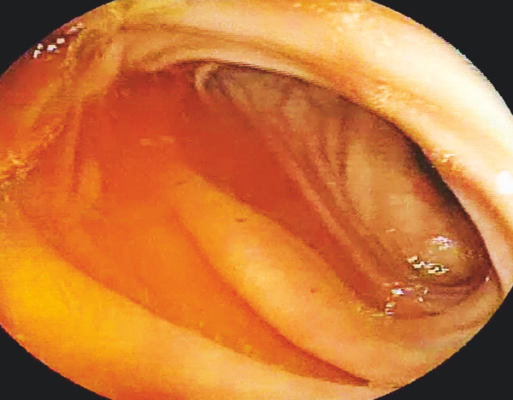Fig. 5