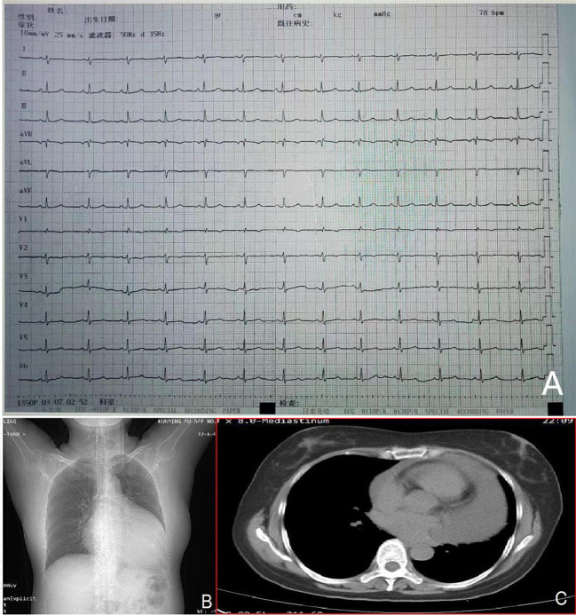Figure 1