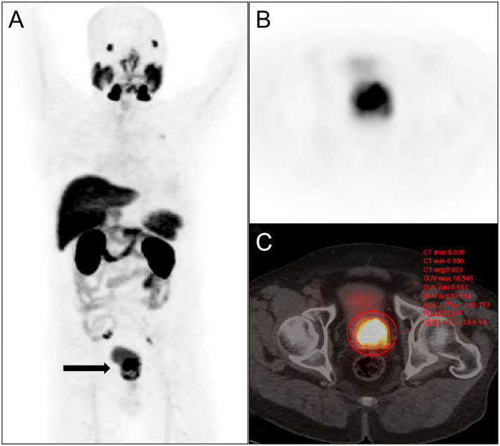 Figure 2