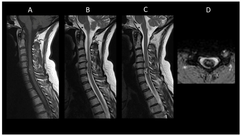 Figure 11