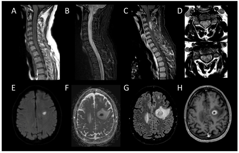 Figure 13