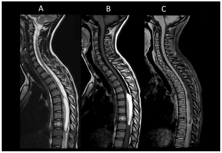 Figure 16