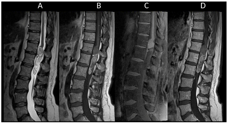 Figure 17