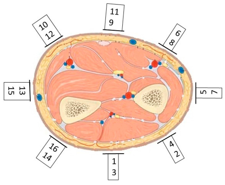 Figure 13
