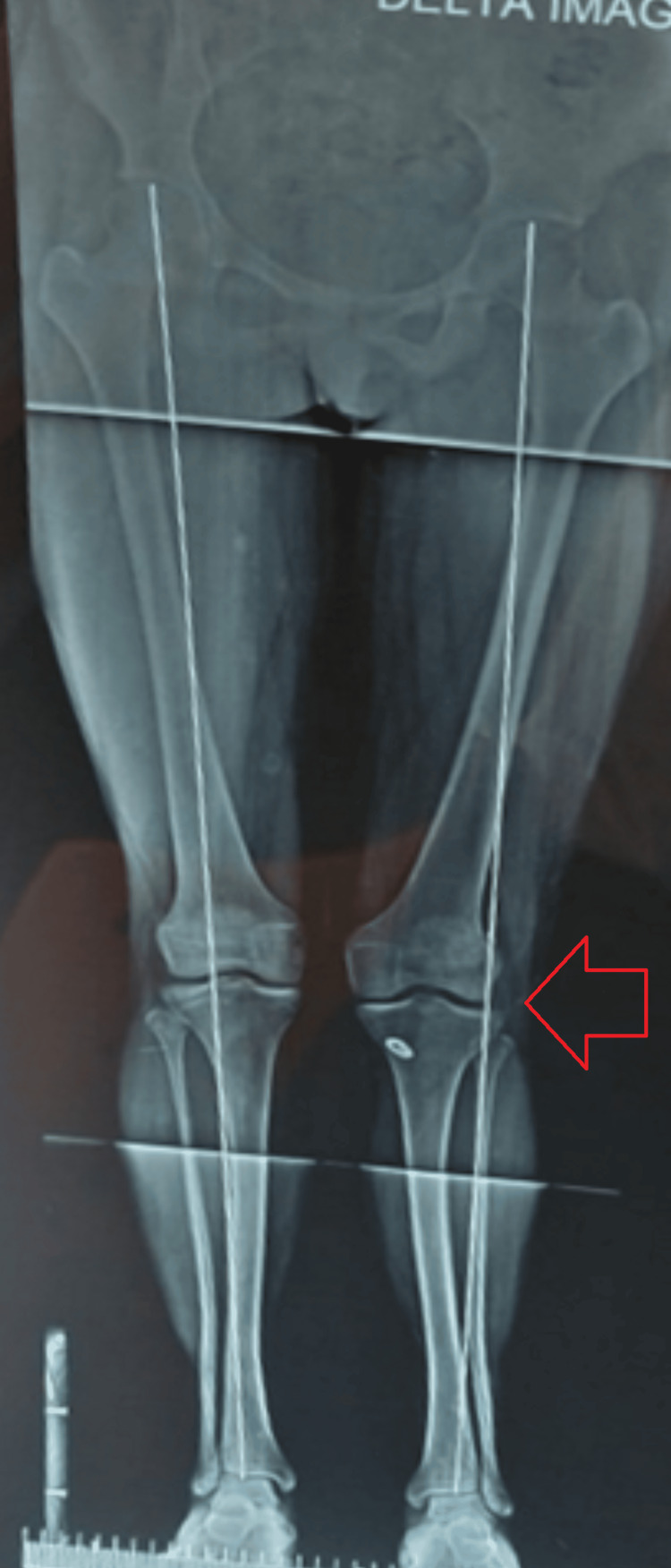 Figure 9