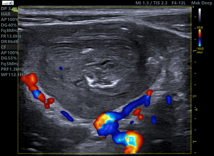 Figure 6