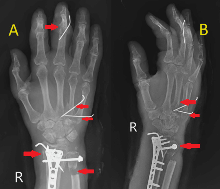 Figure 5