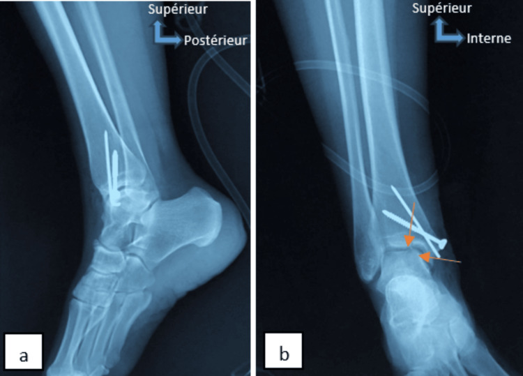 Figure 6