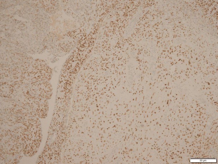 Figure 11