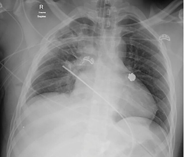 Figure 1