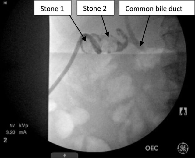 Figure 1