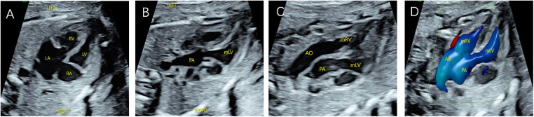 Figure 4