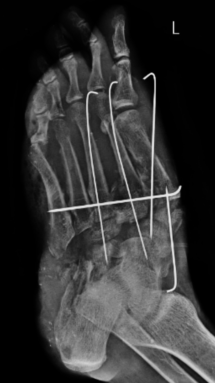 Figure 2